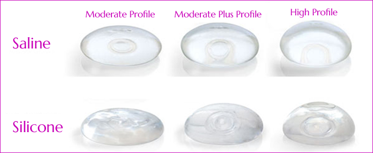 Saline And Silicone Breast Implants 65