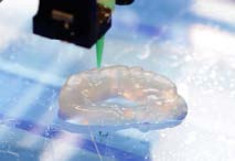 3D printing medical breakthroughs