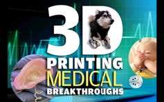 3d printing medical breakthroughs