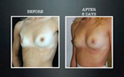 Adivive results