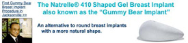natrelle 410 shaped gel breast implant
