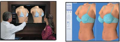 vectra imaging results