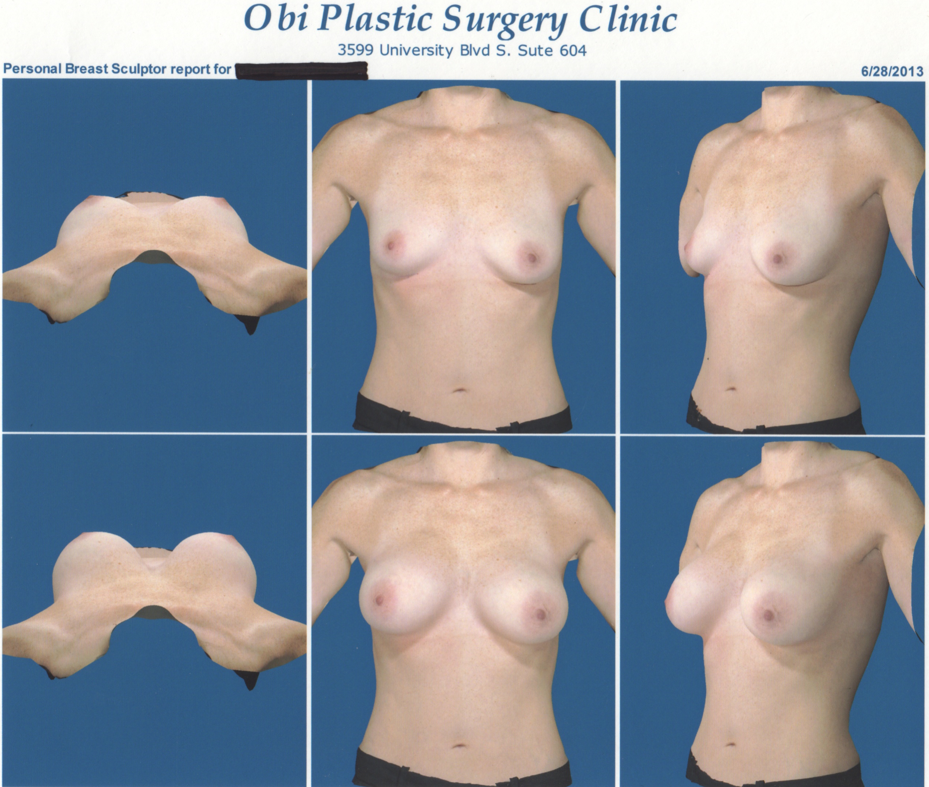 vectra imaging example